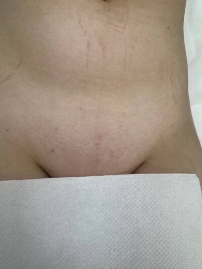 Після 8 процедур